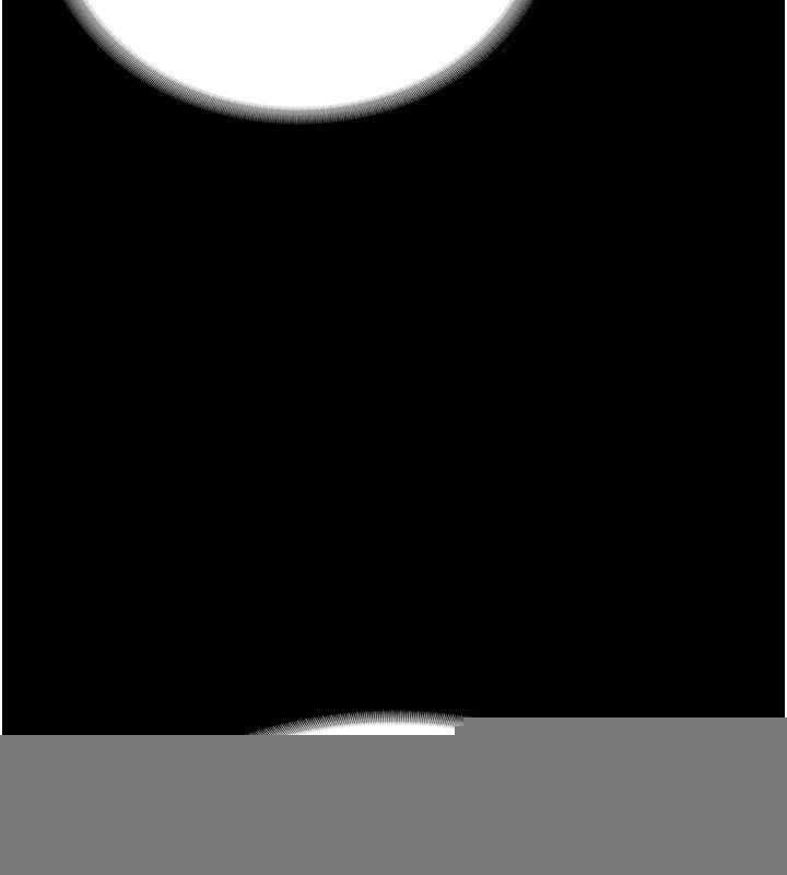 第45話